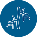Aneurisma